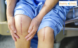top 5 mistakes after knee replacement