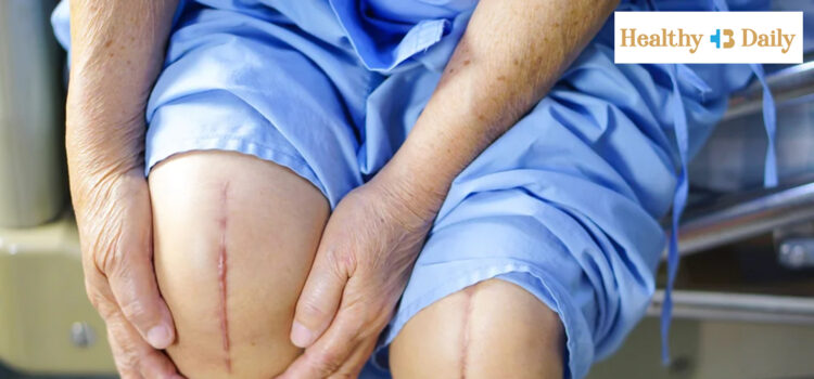 top 5 mistakes after knee replacement