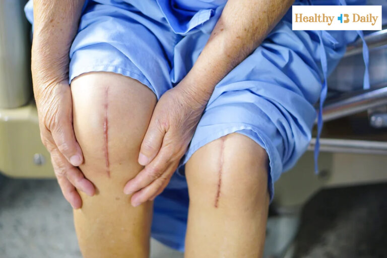 top 5 mistakes after knee replacement