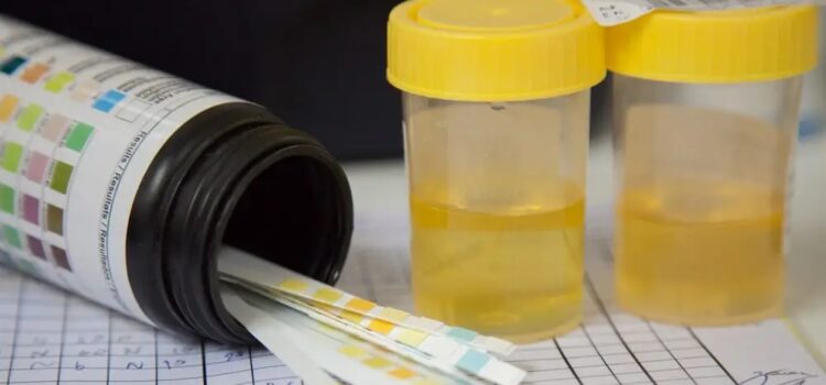 Pass the drug tests easily with fake urine