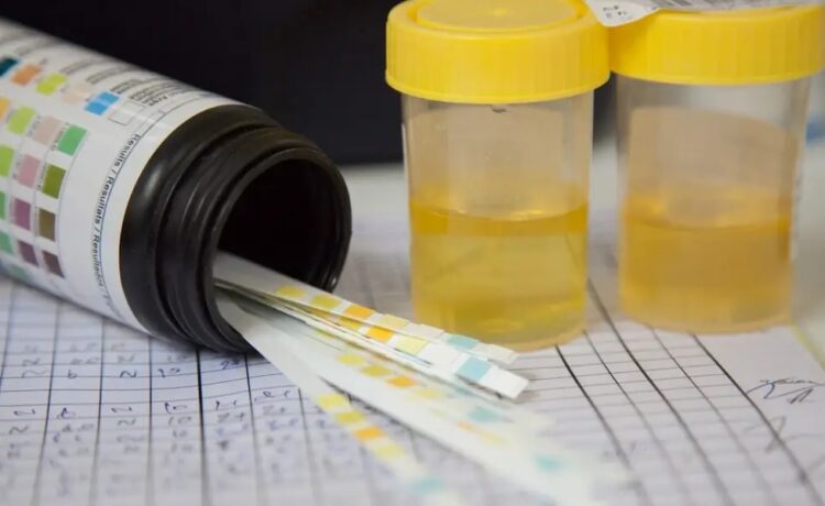 Pass the drug tests easily with fake urine