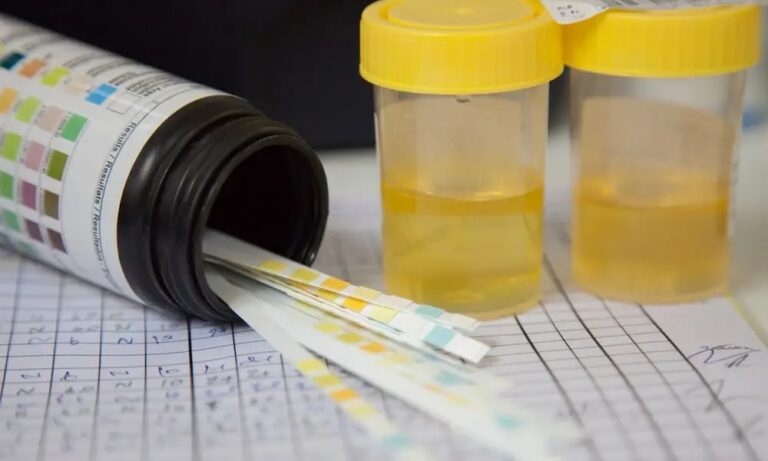 Pass the drug tests easily with fake urine