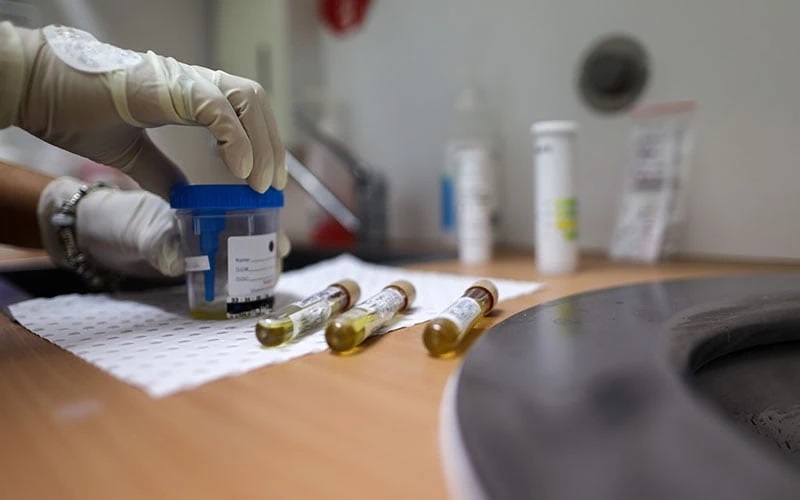 The Vital Role of Drug Testing in Healthcare Healthy B Daily