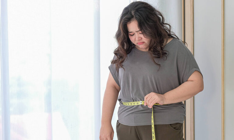 Gastric Bypass Revision