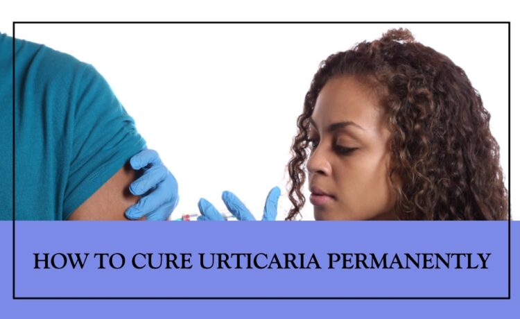 how to cure urticaria permanently
