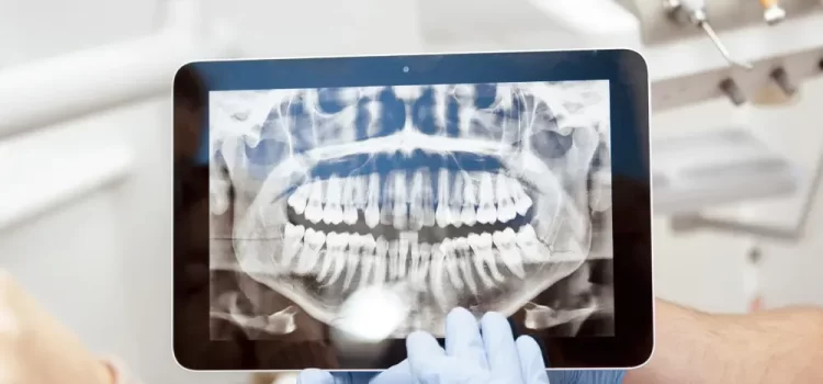 Dental X-Rays