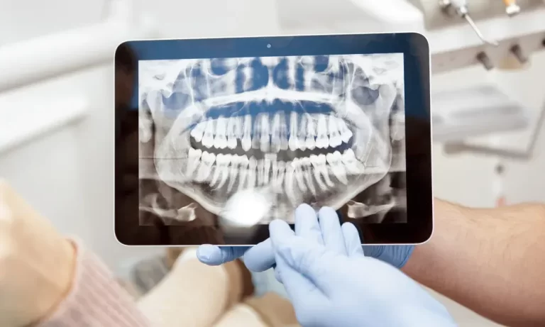 Dental X-Rays