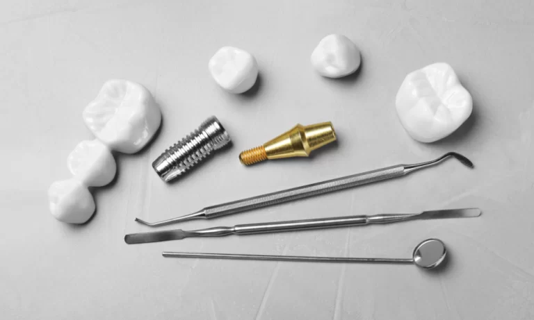 dental implants