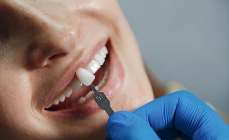 Dental Implants
