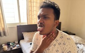 Man checking a dry mouth and sore throat after waking