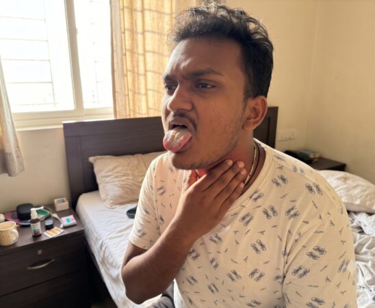 Man checking a dry mouth and sore throat after waking